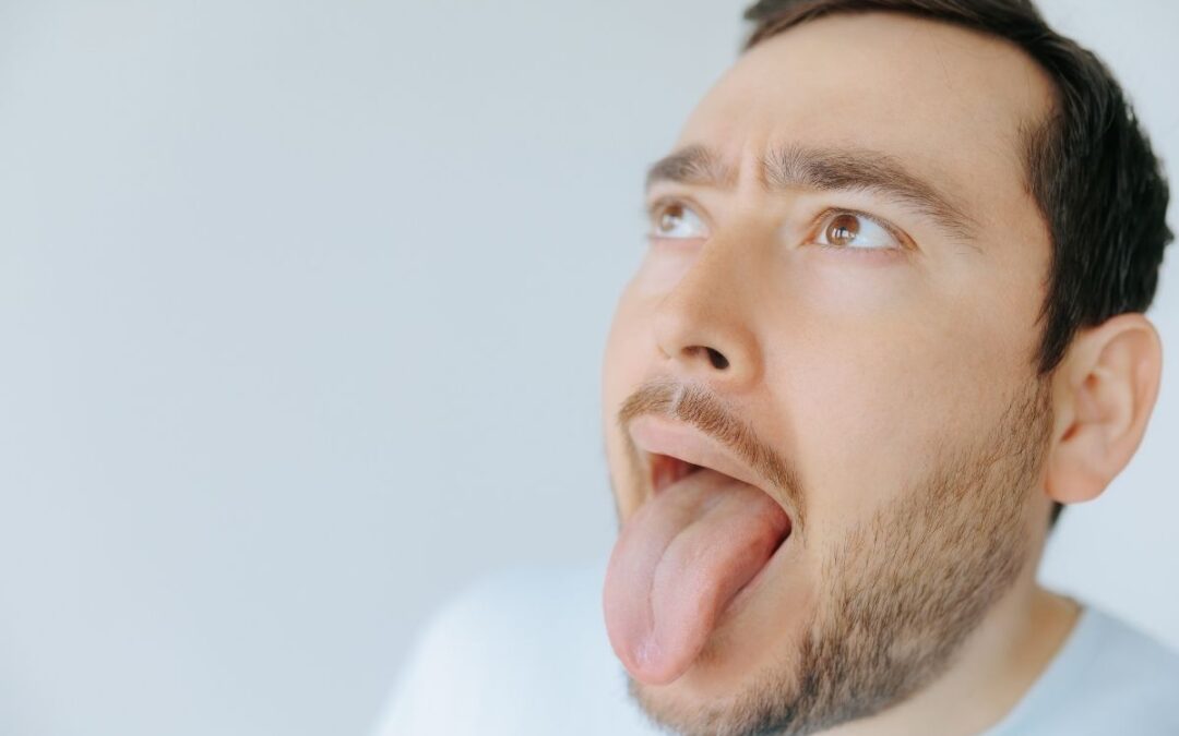How to Get Rid of a Fissured Tongue?