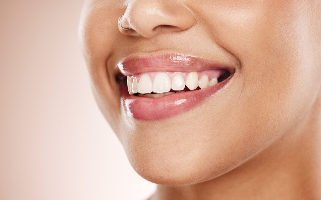 Foods That Stain Your Teeth More Than Coffee